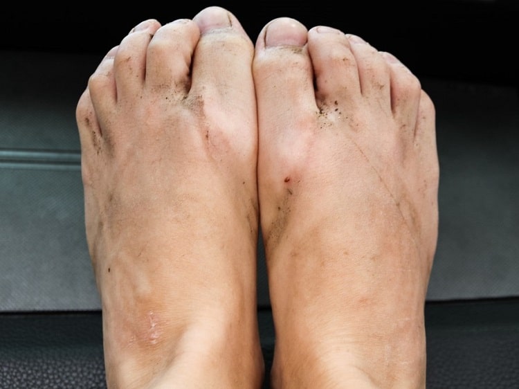 dirty feet after wearing flip-flops in China